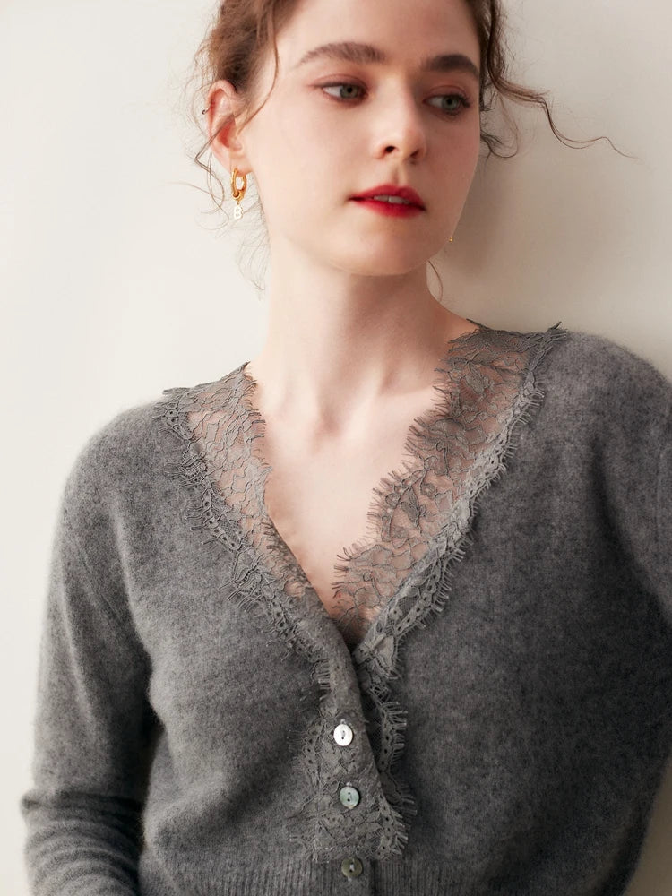 Rosie Fitted Cardigan | Lace Trim Button Front Cardigan 2
